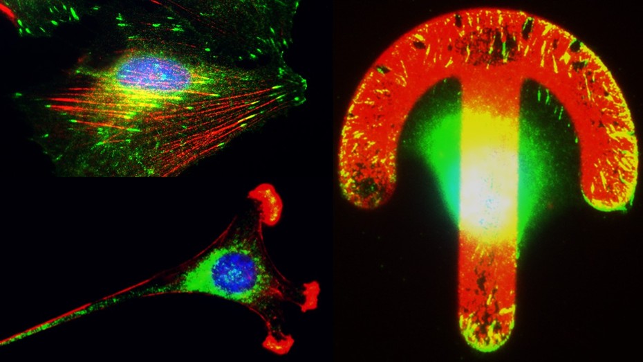 Left: Immunofluorescent labelling of the cytoskeleton in cells; Right: Immunofluorescent labelled cells adapting the shape and position of the cytoskeleton according to artificial patterns