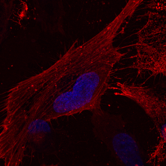 Immunostaining of the nuclei and Actin to visualise the cytoskeleton.