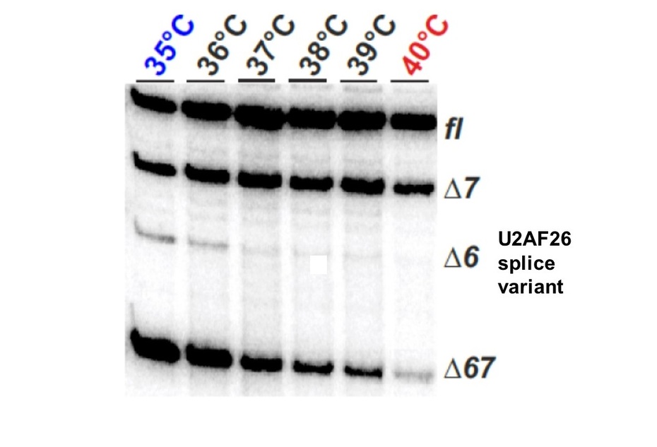 Temperature-dependent alternative splicing visualized by radioactive RT-PCR