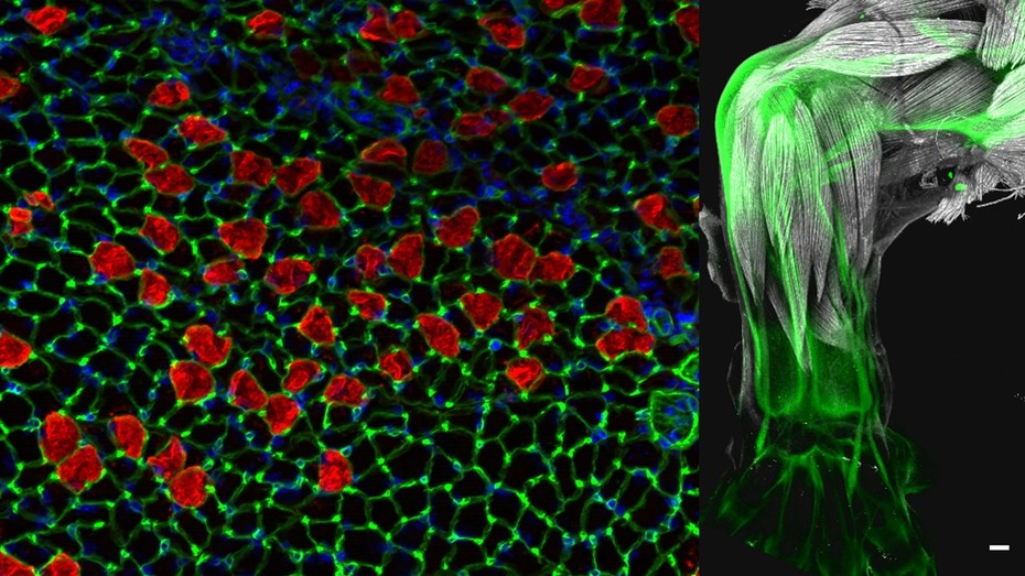 Left: Immunostaining for Collagen IV in basal lamina and myosin heavy chain on a cross section of a postnatal mouse muscle; Right: a limb of a mouse embryo immunolabeled for skeletal muscle myosin and Collagen XII demarcating tendons and ligaments