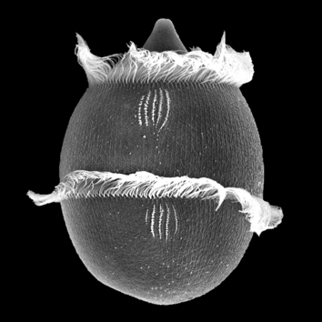 Didinium (räuberischer Ciliat, der von Pantoffeltierchen lebt)
Quelle: Dr. Renate Radek