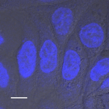 Mit einem Fluoreszenz-Farbstoff angefärbte Zellkerne (Maßstab: 10 µm)
Quelle: Anja Heiduk