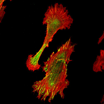 Fibroblasten (rot: F-aktin, grün: Vinculin)
Quelle: Dr. Clemens Franz