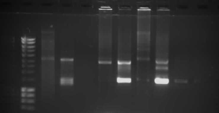 Gelelektrophoretische Auftrennung von PCR-Produkten sowie Produkten eines Restriktionsverdaus
Quelle: Sarah Gogolin