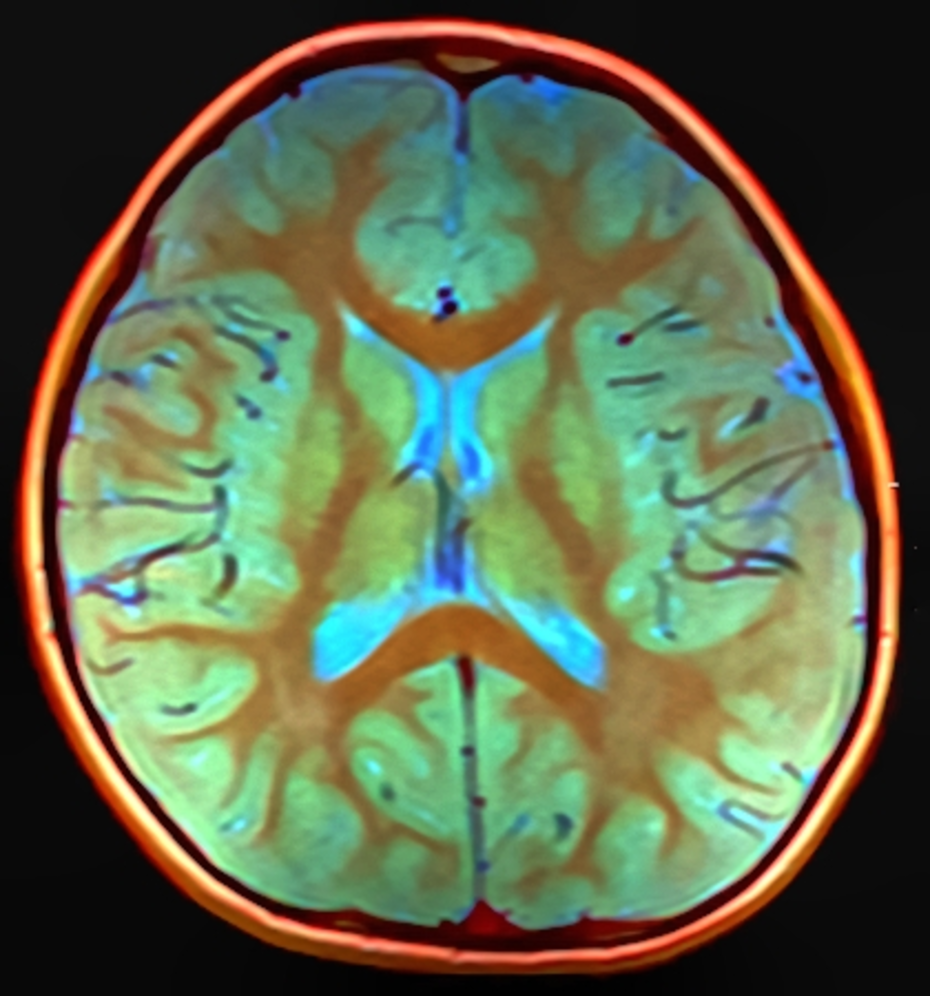 False color brain MRI