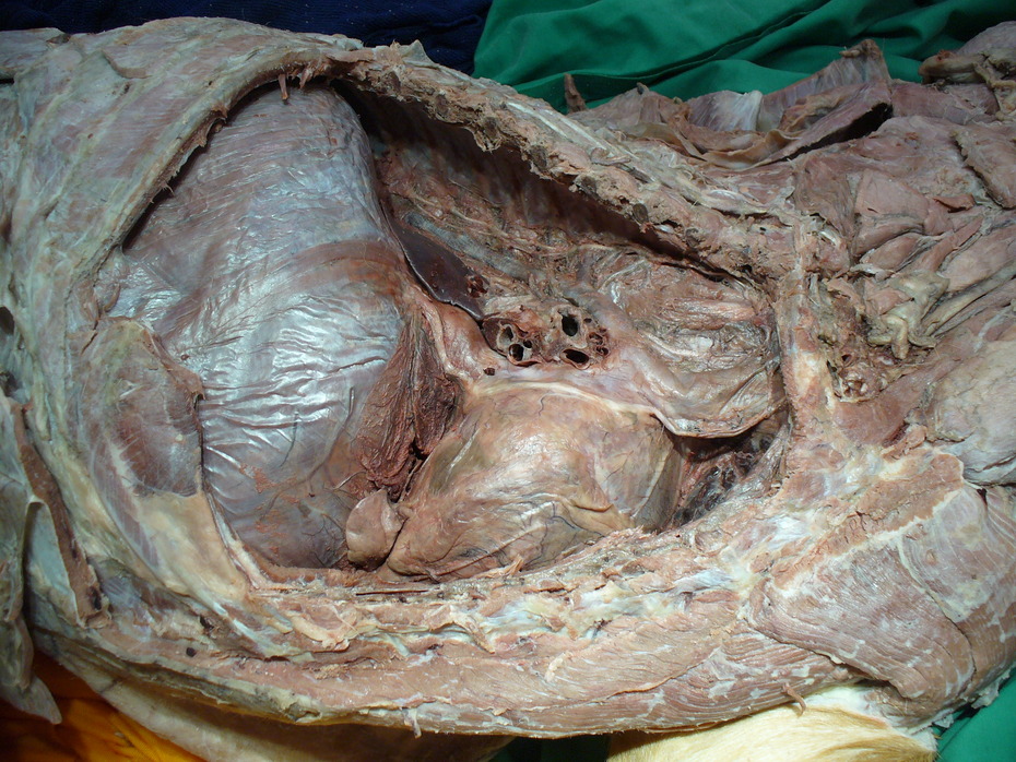 präparierter Brustkorb
Quelle: Institut für Veterinär-Anatomie